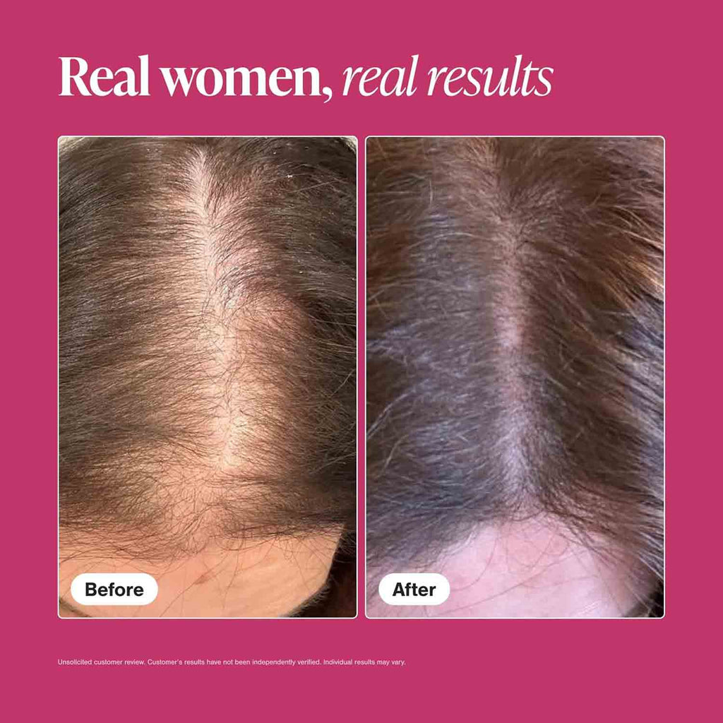 Premium Hair, Skin & Nails Formula — For Volume, Strength & Vibrancy