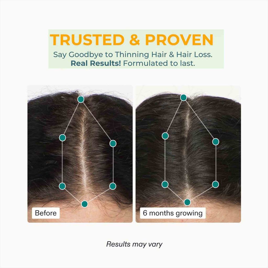 Women's Hair Growth Supplements, Ages 18-44