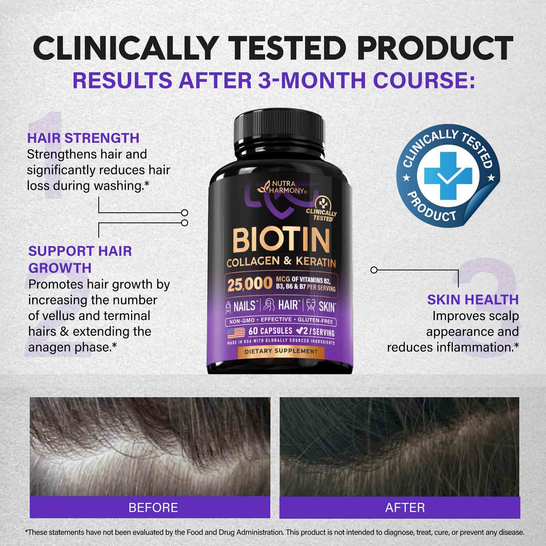Hair Growth Support, Skin, Nails—Support Complex with Biotin, Collagen